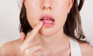 herpes symptoms on lips