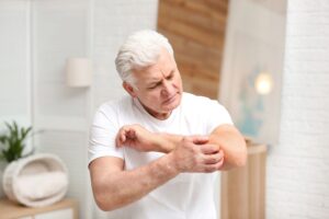 eczema and dermatitis